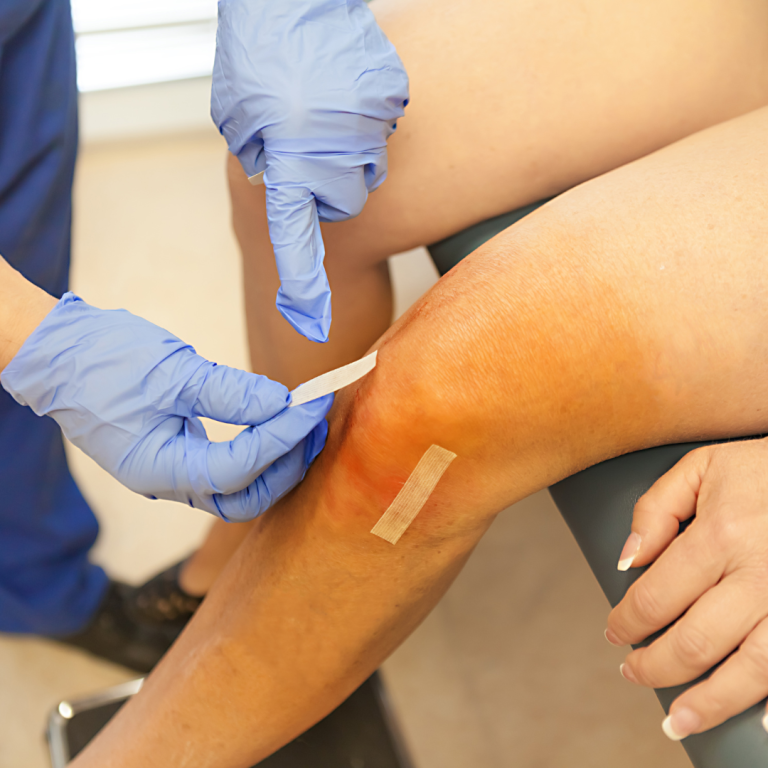 Arthroscopic Surgery